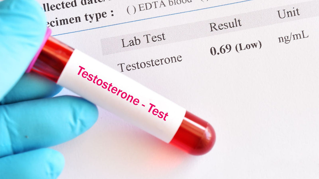 What are the symptoms of low testosterones and what are the cause of it?